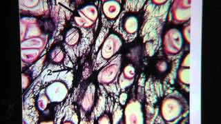 Elastic Cartilage Connective Tissue [upl. by Nicolis972]