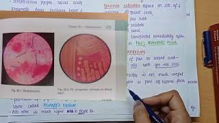 Streptococcus Pyogenes  Morphology  Virulence factors  culture amp lab diagnosis  MICROBIOLOGY [upl. by Renwick]