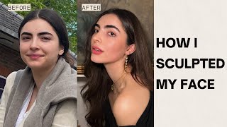 face transformation without surgery my journey controlling pcos amp cortisol [upl. by Nohsed91]