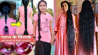 Grow Your HAIR With This Onion Peel HACK😍 Get Longer Thicker HAIR  Nothing To Buy  RuntiMe [upl. by Salim]