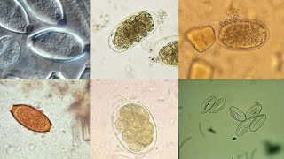 Clinical Parasitology Laboratory  Intestinal Nematode Egg Identification [upl. by Maidel16]