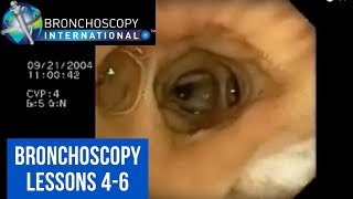 Bronchoscopy Step by Step Details Lessons 46 [upl. by Eikkin]