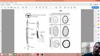 Nematoda  2  Ascaris [upl. by Noellyn346]