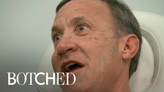 Dr Terry Dubrow Freaks Out Paul With Face Filler Treatment  Botched  E [upl. by Torey]