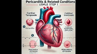 PericarditisCardiac tamponadePericardial effusionUSMLE STEP 1 Review [upl. by Leisam]