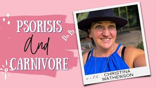 Psoriasis and the Carnivore Diet [upl. by Retrak]