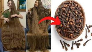 Cloves For Hair Growth Use Cloves To Get Thicker Hair In Less Than 30 Days 🤫 Long Hair Care [upl. by Ahsuas]