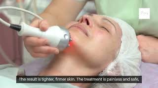 Look Younger Instantly Radiofrequency Skin Tightening in Little Elm [upl. by George]