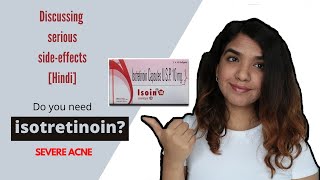 Do you need IsotretinoinAccutane for severe acneBefore and after sideeffects Hindi [upl. by Ykcub]