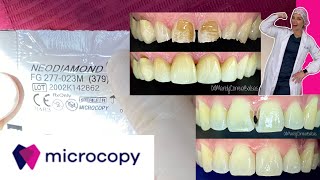 Como usar las FRESAS DENTALES  Colaboración con MICROCOPY DENTAL [upl. by Nodnelg]