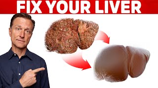 The 6 Best Ways to Heal a Fatty Liver [upl. by Howund]