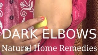 Dark Elbows  Natural Home Remedies [upl. by Yelhs]