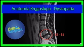 Anatomia Kręgosłupa  Dyskopatia 4 FizjoTerapia HD [upl. by Tiebout811]