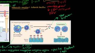 81P DelayedType Hypersensitivity TCellMediated Type IV Hypersensitivity [upl. by Nuahsal270]