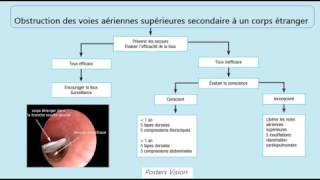 Conduite à tenir devant une dyspnée respiratoire de l’enfant [upl. by Wirth341]