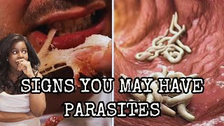 Parasites are a Spiritual Attack Parasite Cleanse amp the Candida Diet [upl. by Ahsekad]