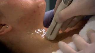 Ultrasound Training Thyroid and Parathyroid Glands [upl. by Enomed]