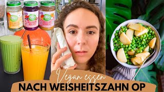 VEGANES FOOD DIARY » Essen nach Weisheitszahn OP Erfahrungsbericht amp Tipps│Food Friday 64 [upl. by Lebasiram]