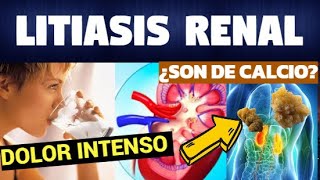 TODO SOBRE LITIASIS RENAL Síntomas Diagnostico y Tratamiento [upl. by Harolda368]