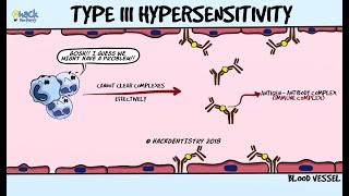 Type III Hypersensitivity  Immune complex disease [upl. by Alra675]