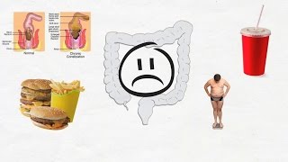 Diarrheal diseases [upl. by Aryajay]