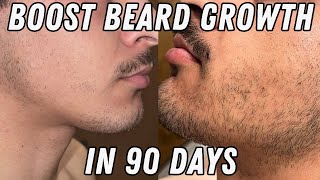 How to Grow a Beard in 90 Days Minoxidil [upl. by Ieppet40]