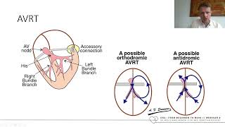 EKG  From Beginner To Boss  Teil 4  Fast amp Furious 2  mit Dr Sebastian Feickert [upl. by Thilda]