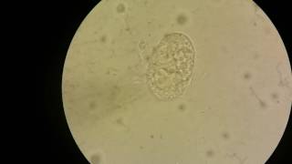 Unfertilised egg of Ascaris lumbricoides [upl. by Smail669]