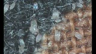 house dust mites [upl. by Vasyuta]