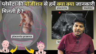 placenta posterior means boy or girl  anterior placenta baby gender  ultrasound se jane ladka [upl. by Leira]