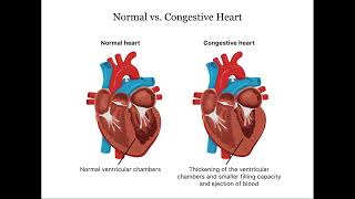 CHF vs Respiratory Failure Crucial Differences [upl. by Ahsitaf666]