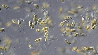 Diatoms live culture [upl. by Jennee]