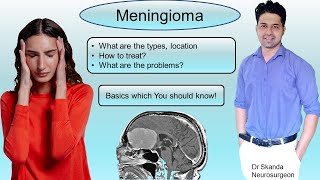 Meningioma Symptoms Treatment Most common benign brain tumor Things U should know By Dr Skanda [upl. by Reteip]