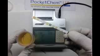 Pocket chem urine analyzer  ACR albumin creatinine ratio [upl. by Templas]