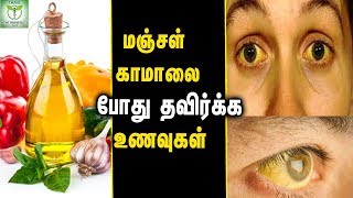 Foods To Avoid During Jaundice  Health tips In Tamil [upl. by Iila]