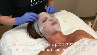 Microdermabrasion with Biocellulose Mask and LightStim Light Therapy [upl. by Onabru168]