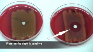 Bacitracin test for Streptococcus pyogenes [upl. by Brynne]