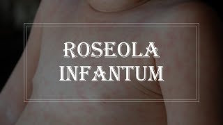 Pediatrics Infectious disease  Roseola infantum exanthem subitum [upl. by Rossing]