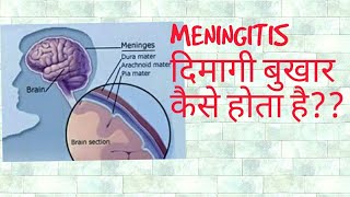 Meningitis in hindi [upl. by Seravart]