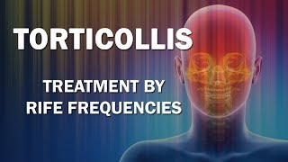 Torticollis  RIFE Frequencies Treatment  Energy amp Quantum Medicine with Bioresonance [upl. by Idnarb]