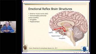 Relaxation and Counterconditioning Therapy for Misophonia Feb 2020 Webinar [upl. by Bear266]