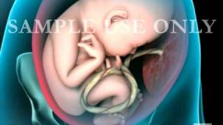 Breech Birth Position  3D Rotation [upl. by Suter]