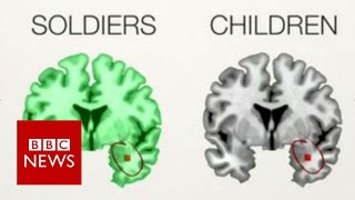 The PTSD brains of children amp soldiers  BBC News [upl. by Celik]