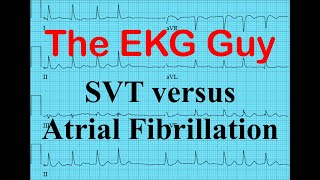 EKGECG  SVT vs Atrial Fibrillation  The EKG Guy  wwwEKGmd [upl. by Novak]