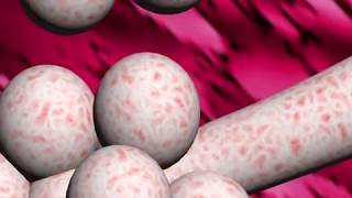 Tuberculosis review  animation and narration by Dr Cal Shipley MD [upl. by Lazos288]