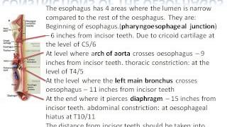 constrictions of oesophagus [upl. by Adur319]