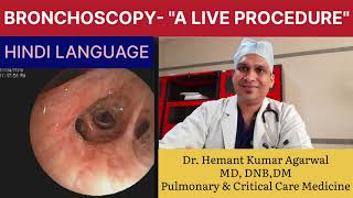 BRONCHOSCOPY quotA Live Procedurequot HINDI Basic A to Z about FOB Anatomy of Bronchi Dr Hemant K A [upl. by Rois310]