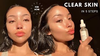 MY UPDATED SKINCARE ROUTINE  unsponsored skincare for acne [upl. by Ahaelam]