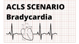 Management of Bradycardia  ACLS scenario [upl. by Ahsehyt]