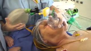 Intubation orotrachéale IOT  bases anatomiques et technique de réalisation [upl. by Gnilsia331]